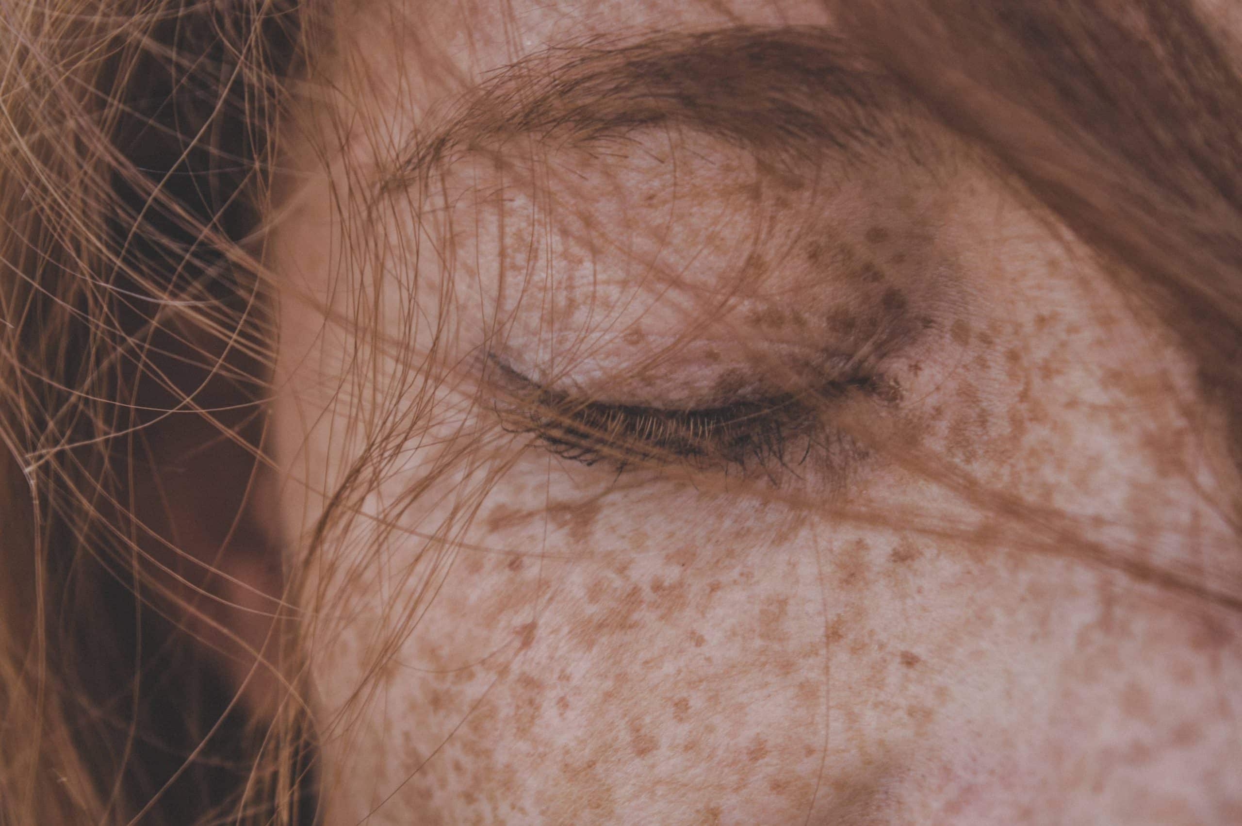 s&eacute;cheresse peau